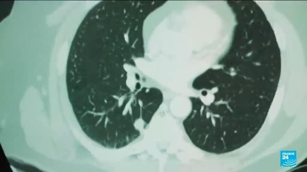 Video thumbnail for Researchers use AI to detect cancer