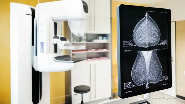'Video thumbnail for Early detection and healthy habits key in fight against breast cancer'