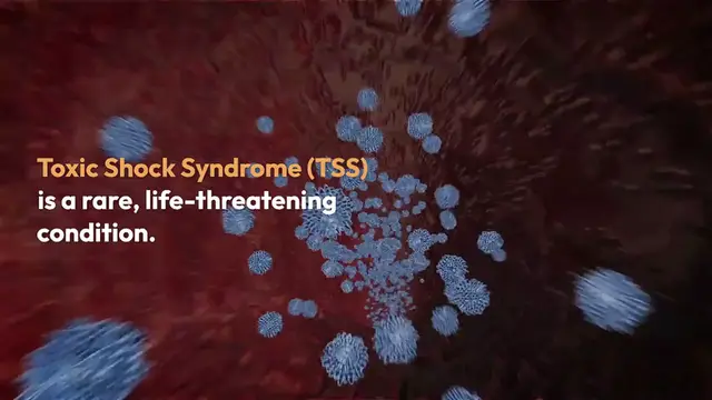Video thumbnail for Understanding Toxic Shock Syndrome