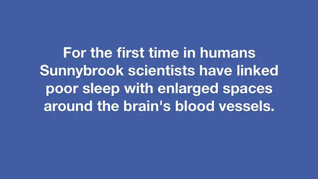 Video thumbnail for Poor sleep may affect brain's ability to clear waste
