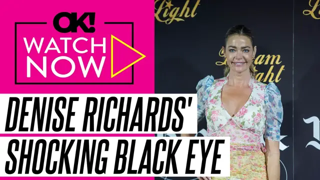 'Video thumbnail for Denise Richards Spotted With Black Eye Days After Her Unexpected Visit to Ex Aaron Phypers' Home'