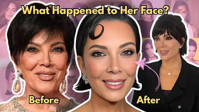 Video thumbnail for Kris Jenner’s Uncanny Facelift & the Dystopian Future of Aging