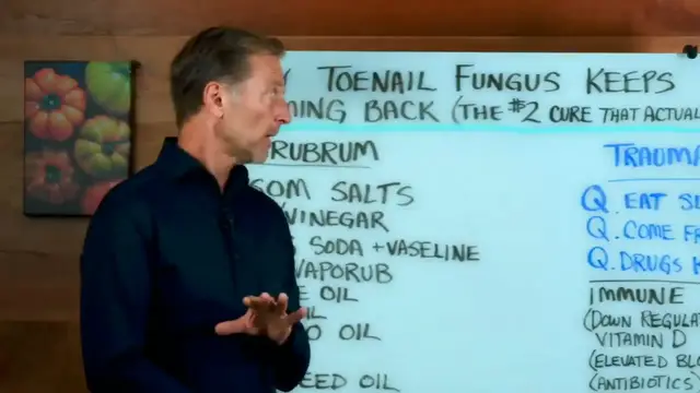 Video thumbnail for Why Toenail Fungus Keeps Coming Back (The  2 Cure That Actually Works)(720P HD)
