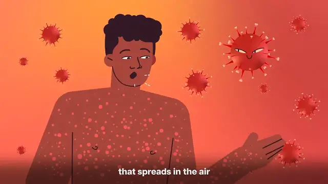 Video thumbnail for Why Should You Get the Rubella Vaccine