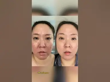 'Video thumbnail for 🌟 Discover the Secret to Youthful Skin! 🌟'