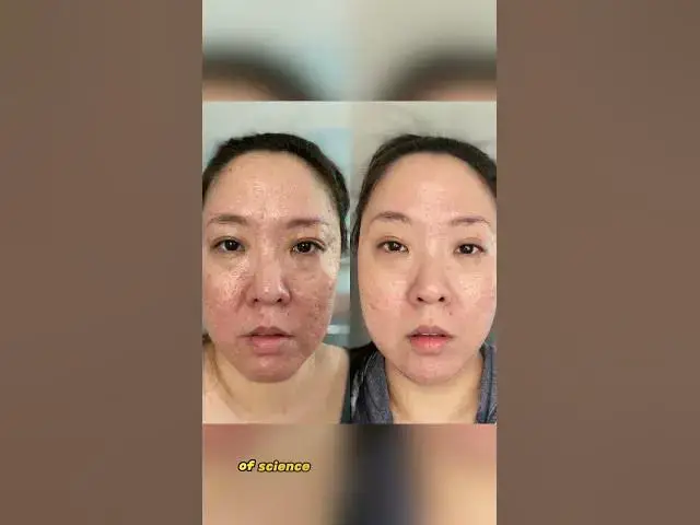 'Video thumbnail for 🌟 Discover the Secret to Youthful Skin! 🌟'