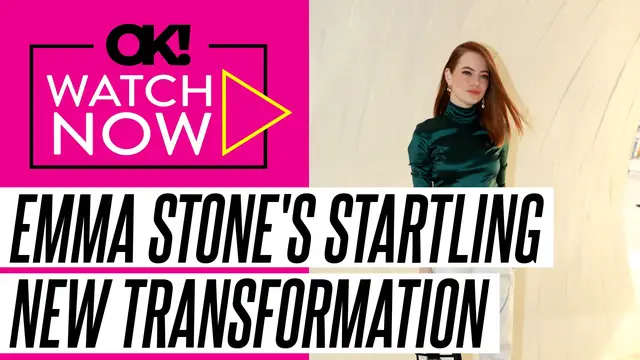 'Video thumbnail for Emma Stone's 'Scary' New Look Is a Result of an Eyelid and Face Lift, Plastic Surgeon Claims'