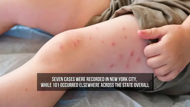 Video thumbnail for New York Declares Measles Disaster Emergency as Cases Rise.