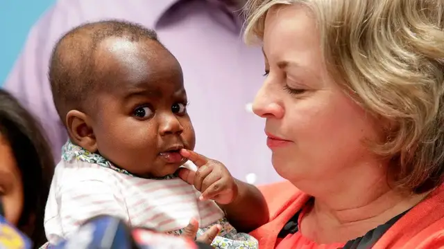 Video thumbnail for Doctors remove extra legs, spine from infant