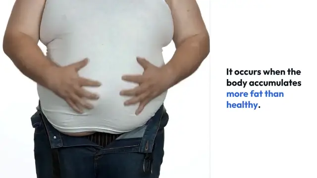 Video thumbnail for Understanding Obesity Signs and Causes
