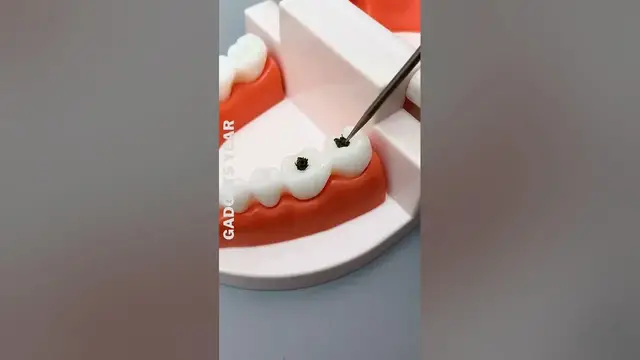 Video thumbnail for Product Link in Bio ✅ | Tactical Self-Defense Keychain | #viral