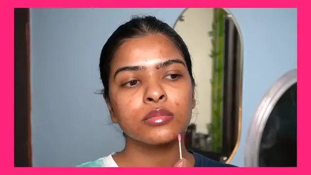 Video thumbnail for Weekly GLOW Up Routine of a Girl with PCOD ✨ Body_Butt Acne, Facial Hair, Acne marks, Hair Loss..
