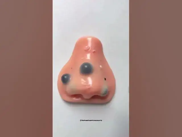 Video thumbnail for Satisfying Slime & Wax Pops ASMR | Oddly Satisfying Pimple Popping Simulatio#shorts #viral  #boost #