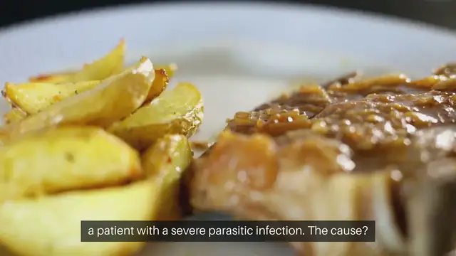 Video thumbnail for "Doctor Shares Alarming CT Scan of Legs Infested with Parasites from Undercooked Pork"