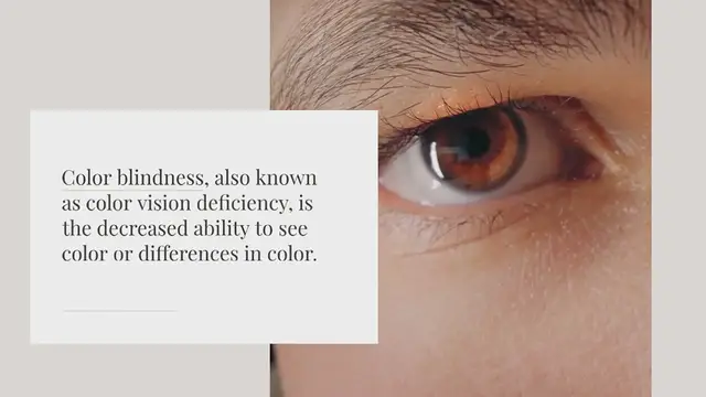 Video thumbnail for Is color blindness on the Y chromosome?