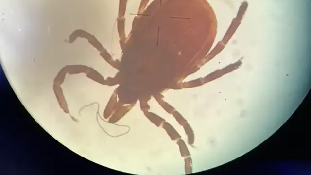 Video thumbnail for Tick danger rising as officials report high rates of disease-carrying ticks this summer