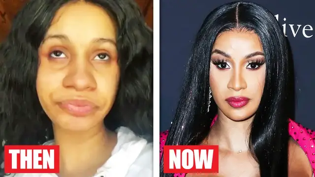 Video thumbnail for Celebrities Who Spent a Fortune to Completely Change Their Appearance