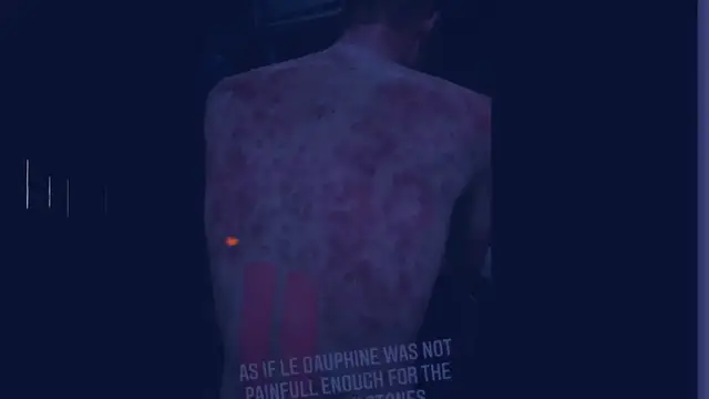 'Video thumbnail for Une violente tempête de grêle frappe les cyclistes et les spectateurs du Critérium du Dauphiné'