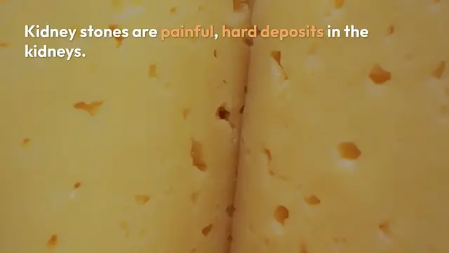 Video thumbnail for Preventing Kidney Stones Tips