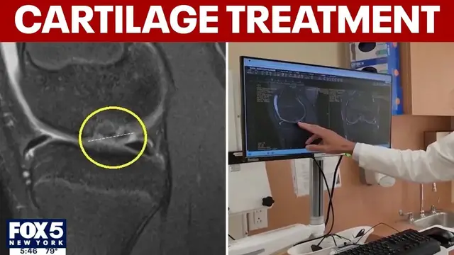 Video thumbnail for New treatment for cartilage problems