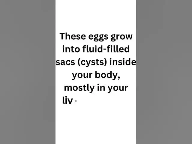 Video thumbnail for What Do You Know About Hydatid Cysts?