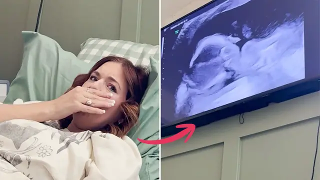 Video thumbnail for Woman Given 0.1 Percent Chance Of Getting Pregnant After Bone Marrow Transplant Surprised With News