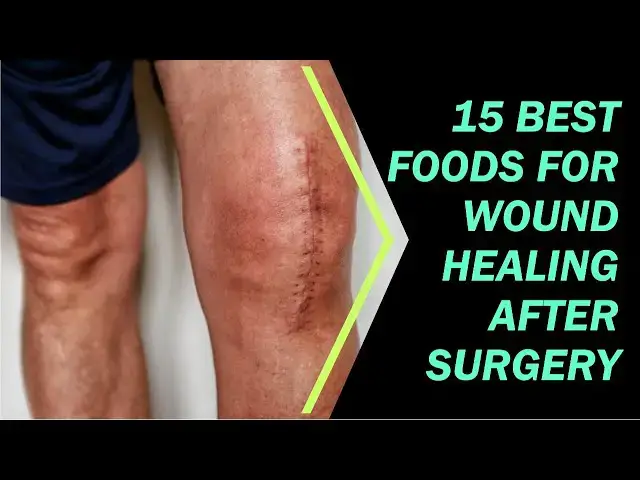 Video thumbnail for 15 Best Foods for Wound Healing after Surgery