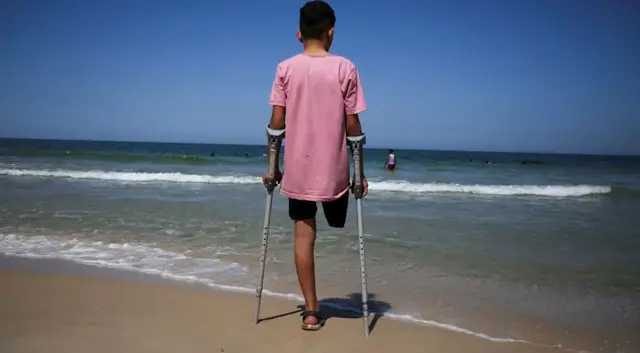 'Video thumbnail for War leaves Gaza with modern history’s worst child amputee crisis amid aid blockade'