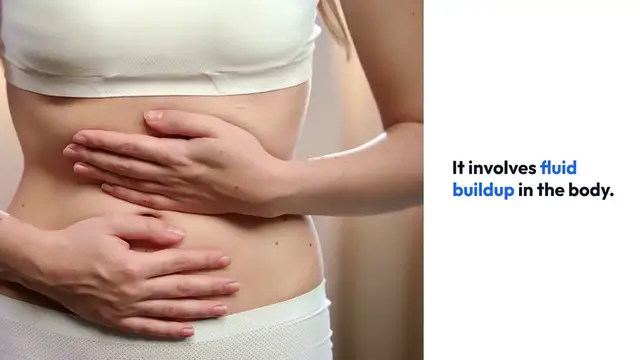 Video thumbnail for Understanding Edema Causes Explained