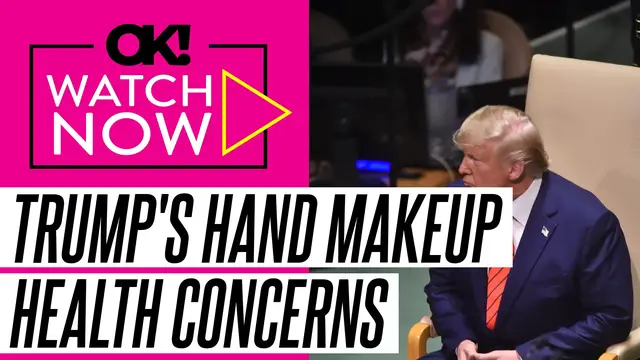 'Video thumbnail for Donald Trump's Hand Makeup Raises New Health Concerns After Cankles Cover-Up Goes Viral'