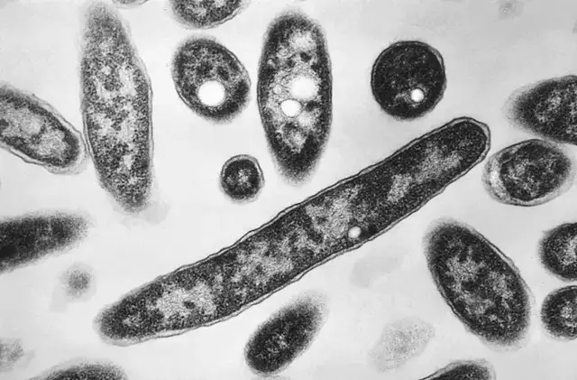 Video thumbnail for Officials identify Bronx cooling towers possibly linked to deadly Legionnaires' cluster