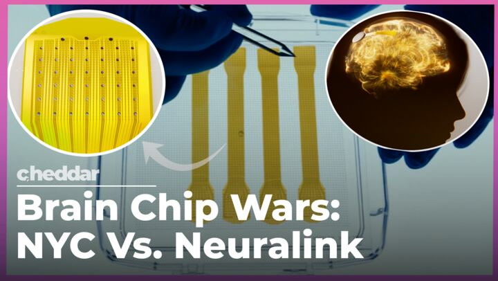 Video thumbnail for This NYC Startup Is Implanting More Brain Chips Than Neuralink