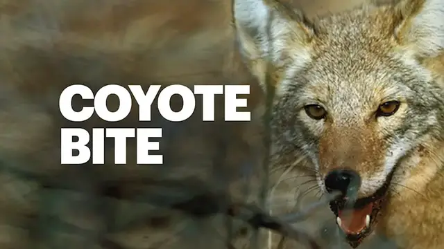Video thumbnail for Woman hospitalized after coyote bite in Hastings-on-Hudson