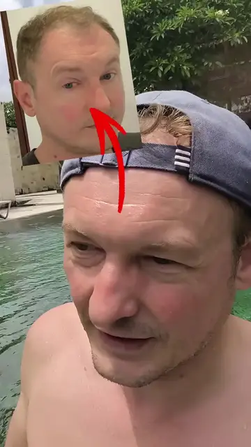 Video thumbnail for Don’t Use Tap Water in Cambodia ❌💧 My Pink Eye Story & Important Travel Tip 🚨