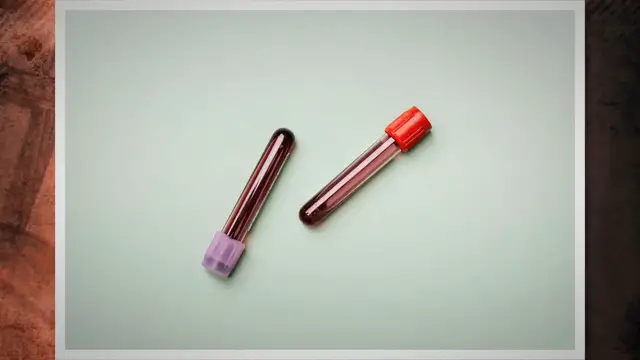 'Video thumbnail for The Bible and Rh-Negative Blood: What Does the Scripture Say?'