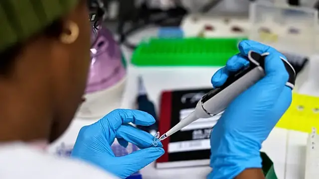 Video thumbnail for African lab scientists gather in Togo to discuss challenges amid Ebola crisis