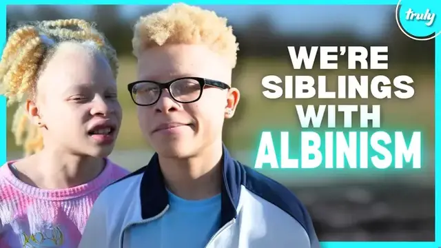 'Video thumbnail for I’m A Mom Of 2 Albino Children | BORN DIFFERENT'