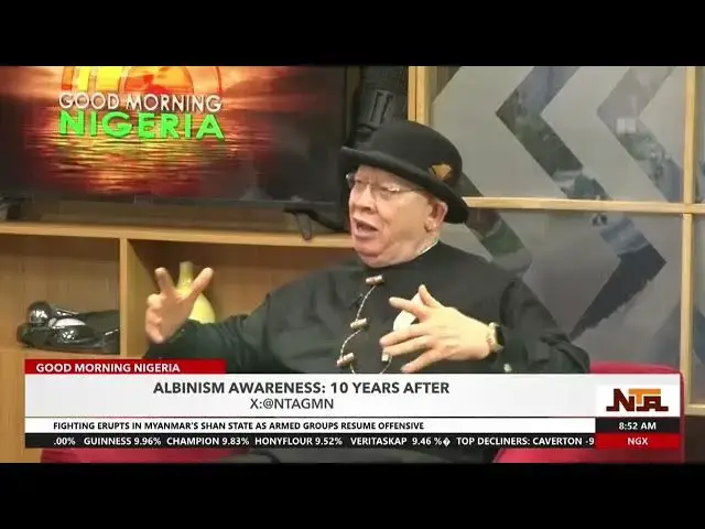'Video thumbnail for Problems of Women With Albanism | 5th July 2024 | NTA'