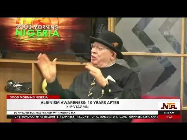 Video thumbnail for Nigeria The First Country In The World To Fomulate National Policies For Albanism | 5th July | NTA