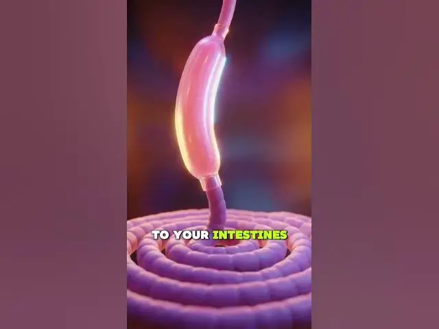 Video thumbnail for How Stomach Stapling Actually Works (explained)