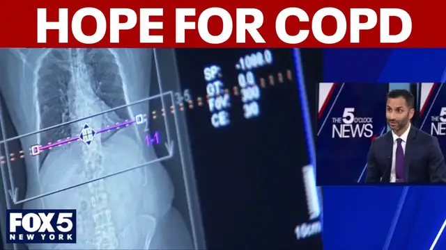 Video thumbnail for New drug cuts severe COPD flare-ups by 30%, study shows