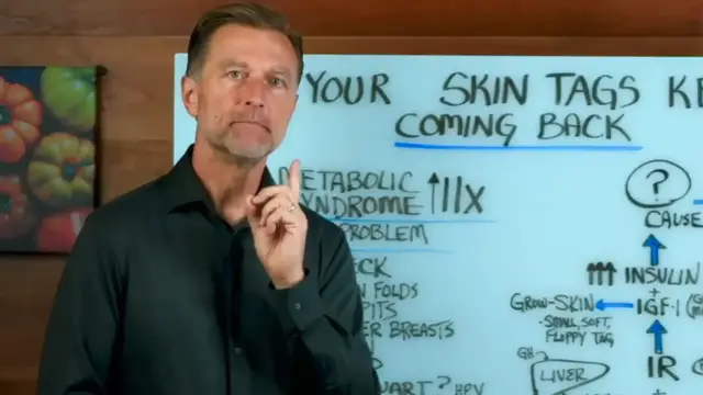 Video thumbnail for How to Get Rid of Skin Tags (  Stop Them For Good)(720P HD)