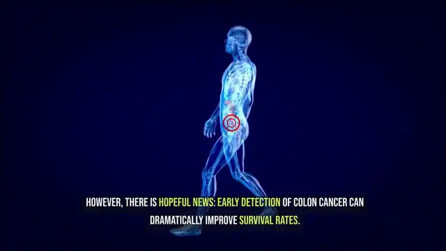 Video thumbnail for Early Colon Cancer Signs to Watch For