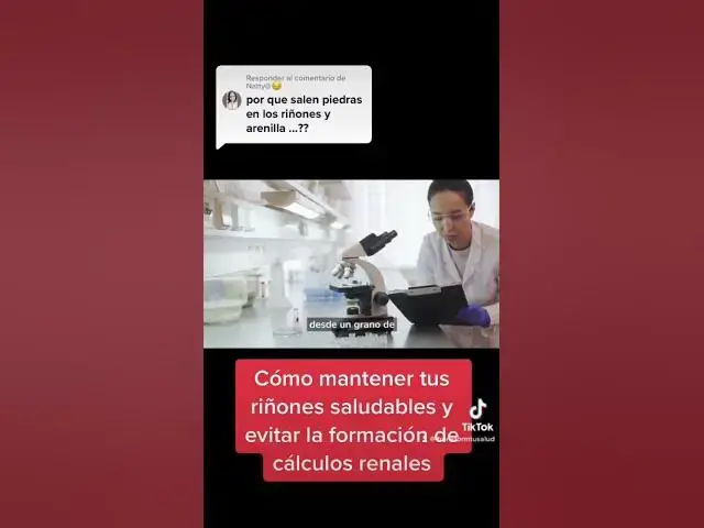 'Video thumbnail for Cómo mantener tus riñones saludables y evitar la formación de cálculos renales #CuidadoRenales'