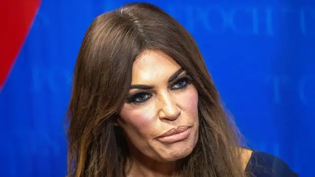 Video thumbnail for Kimberly Guilfoyle's Worst Looks Just Scream Plastic Surgery
