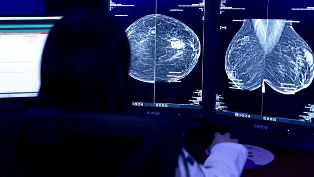 Video thumbnail for How AI is helping Mexico detect breast cancer earlier