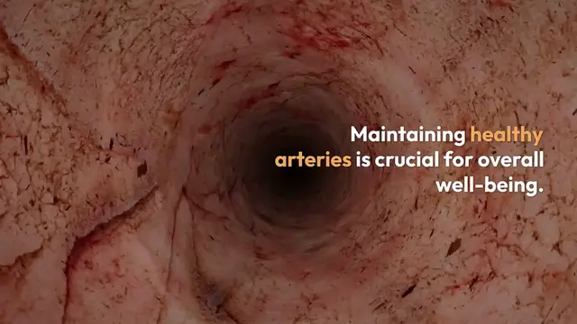 Video thumbnail for Strategies for Arterial Health