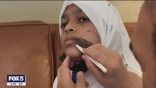 Video thumbnail for Free facial surgery gives teen a new chance at life