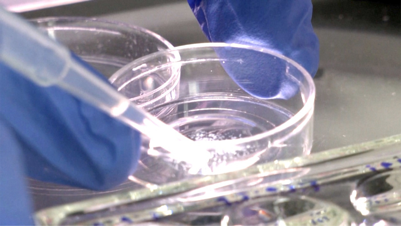Video thumbnail for In 2023, Israeli scientists grew the world's first synthetic human embryo without eggs or sperm