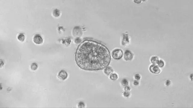 Video thumbnail for A closer look at robots built entirely from human cells